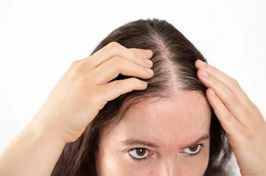 Causes of Women’s Hair Loss