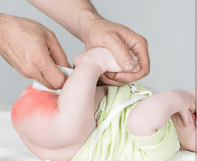 Side Effects Of Diapers